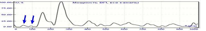 График мощности ЗВП на вспышку света (вверху) и график мощности ЗВП на изменение изображения (внизу). Обращает внимание дополнительный (второй) ранний компонент. 