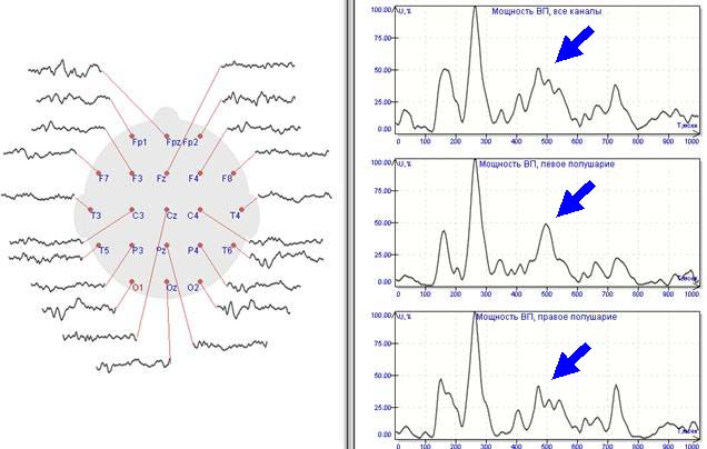 Графики мощности ЗВП при усреднении значимых и незначимых стимулов 1:1. Та же запись, тот же испытуемый. Повышение уровня пиков в области 400-700 мсек.