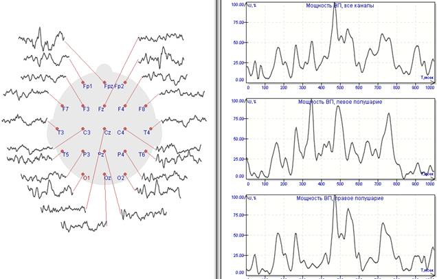 График мощности ЗВП для значимых стимулов. Доминируют пики в областях после 300 мсек., отмечается выраженная межполушарная асимметрия