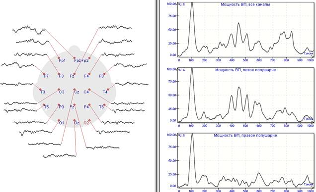 Слуховые вызванные потенциалы (100 усреднений), соотношение значимых и незначимых стимулов – 1:4. На графиках мощности хорошо видна межполушарная асимметрия в областях 350-550 мсек
