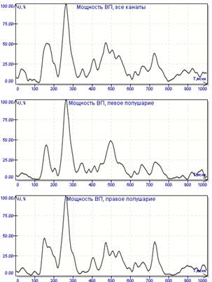 Графики мощности слуховых ВП (слева) и ВП на изменение изображения (справа). Усреднение при соотношении значимых и незначимых стимулов 1:1, при стимуляции соотношение было 1:4 в обоих случаях