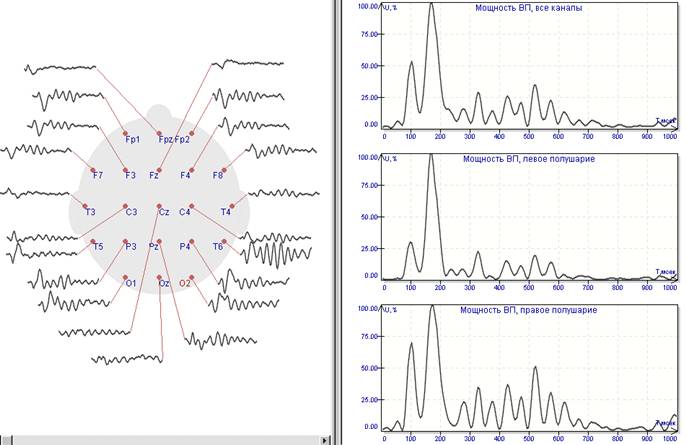 Длиннолатентные ЗВП, (200 стимулов) и их графики мощности. Фотостимулятор светодиодный, длительность вспышки 8 мсек. Стимуляция симметрично на оба глаза, глаза закрыты
