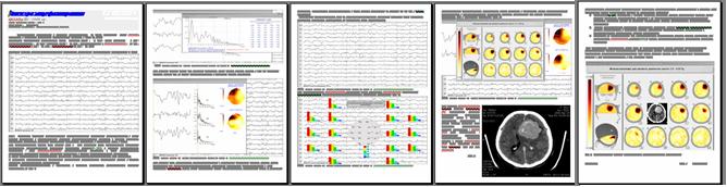 Рис.10. Образец отчета электроэнцефалографического исследования