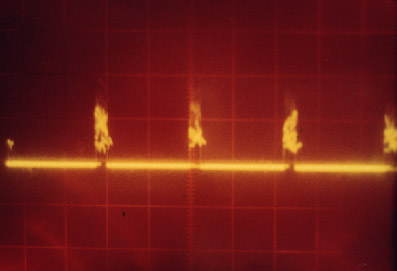 Fig.1 Snapshot from oscillograph  C1-83 screen, scanning 2mV/point,  2 msec/point. Ericsson A1018S  900 MHz phone. NaCl solution.  AgCl </p>
<p>weak-polarized EEG electrodes. Proper observation. 