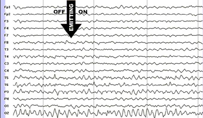 Fig.4. The EEG of a healthy patient. The patient's eyes are closed. Moment of turning the cellular phone on is marked with an arrow. The registration is done on </p>
<p>the ExpertTM EEG system, made by the TREDEX Company Ltd. (Kharkov, Ukraine).