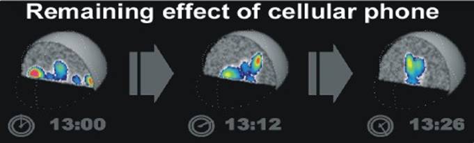 Fig.7. Decrease in intensity of the local changes in EEG after turning the cellular phone off. Proper observation.