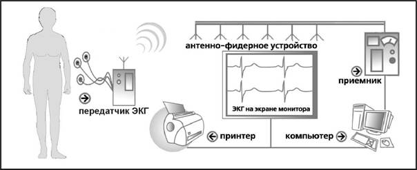 Схема функционирования системы телеметрического контроля ЭКГ «RADIOHOLTER» 